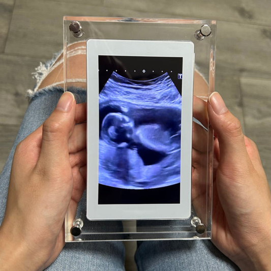 Quadro Digital - Glowframe®